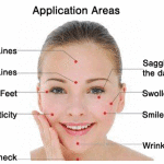 Facial Rejuvenation Cosmetic Acupuncture